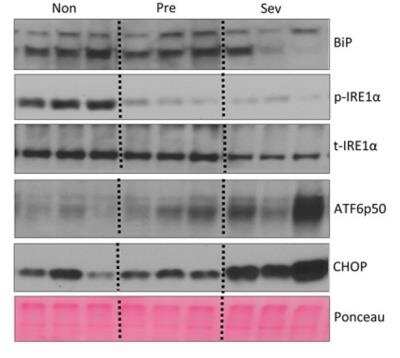 Western Blot Analysis of IRE1 alpha in Three Groups of Mouse Liver